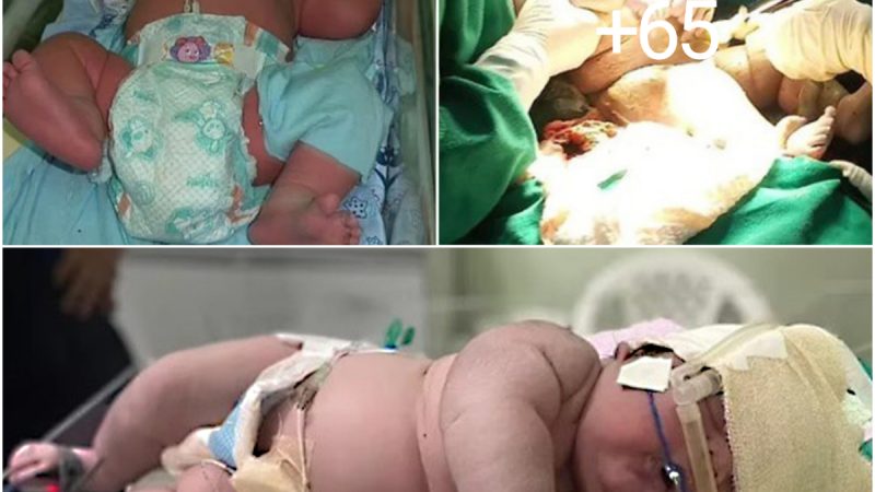Incredible but true: brazilian woman gives birth to a 7.3 kg baby in 9-month-old clothes