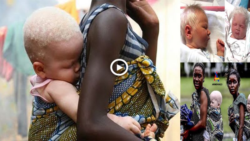 Woman Gave Birth To Rare Αlbino Twins With Snow-White Hair – Their Unusual Beauty Ϲomes Out Years Later
